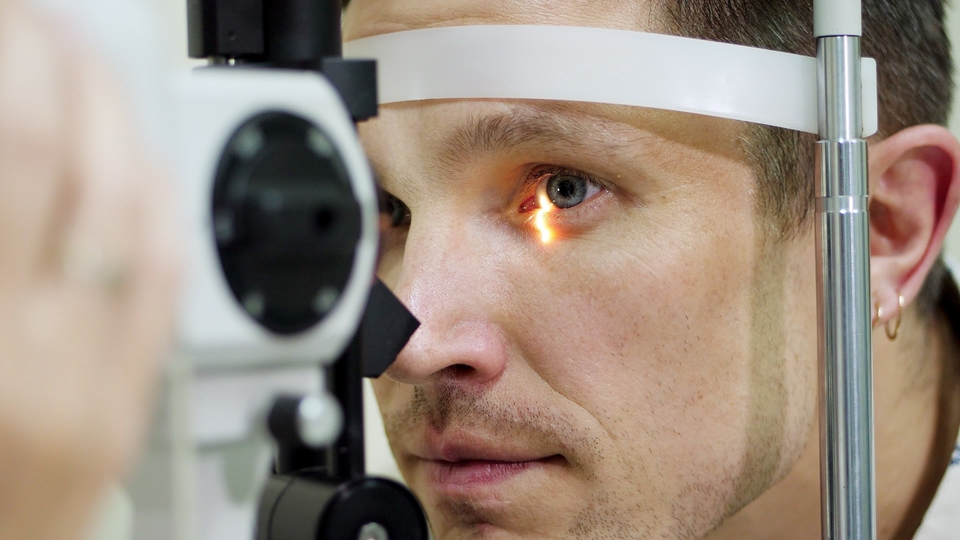 keratoconus 2